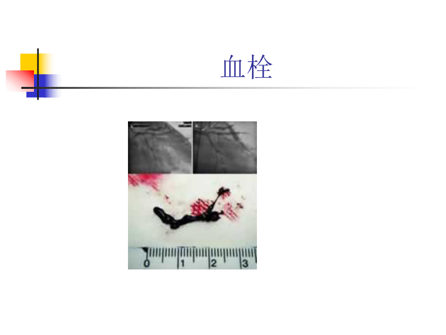 第三章老年人的健康保健（课件）.ppt_第1页