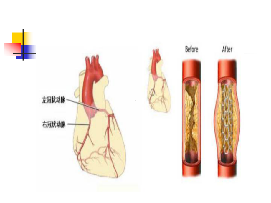 第三章老年人的健康保健（课件）.ppt_第3页