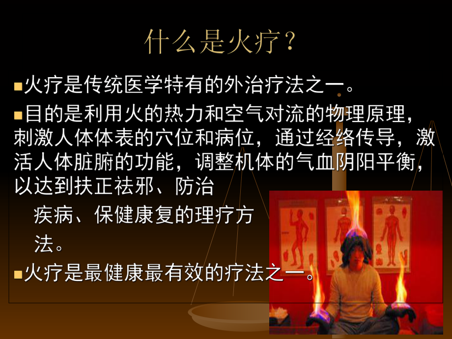 火疗培训课件赵献超 2PPT.ppt_第2页