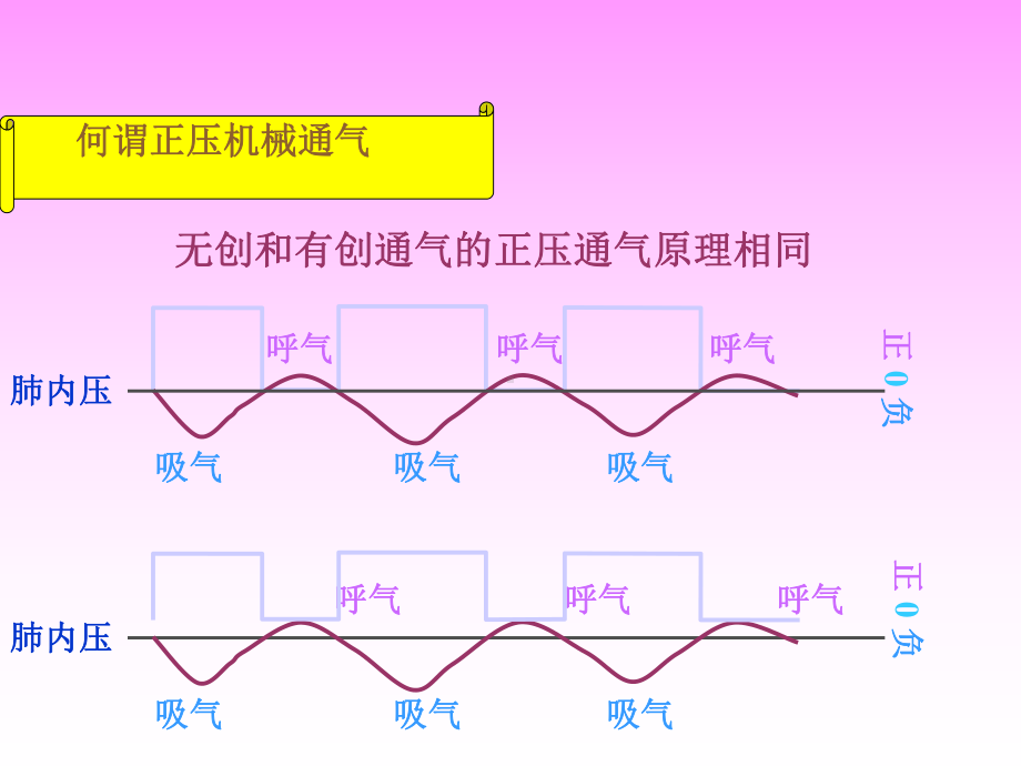 无创通气技术课件.ppt_第2页