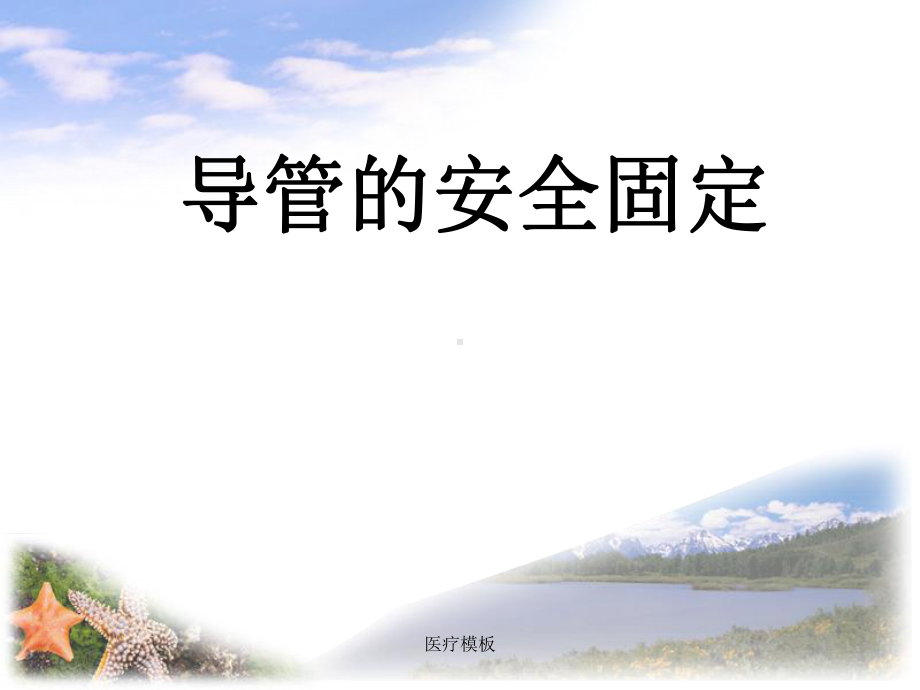 各种导管的安全固定详细(模板参考)课件.ppt_第1页