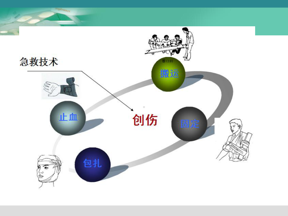 止血、包扎、固定、搬运术课件.ppt_第2页