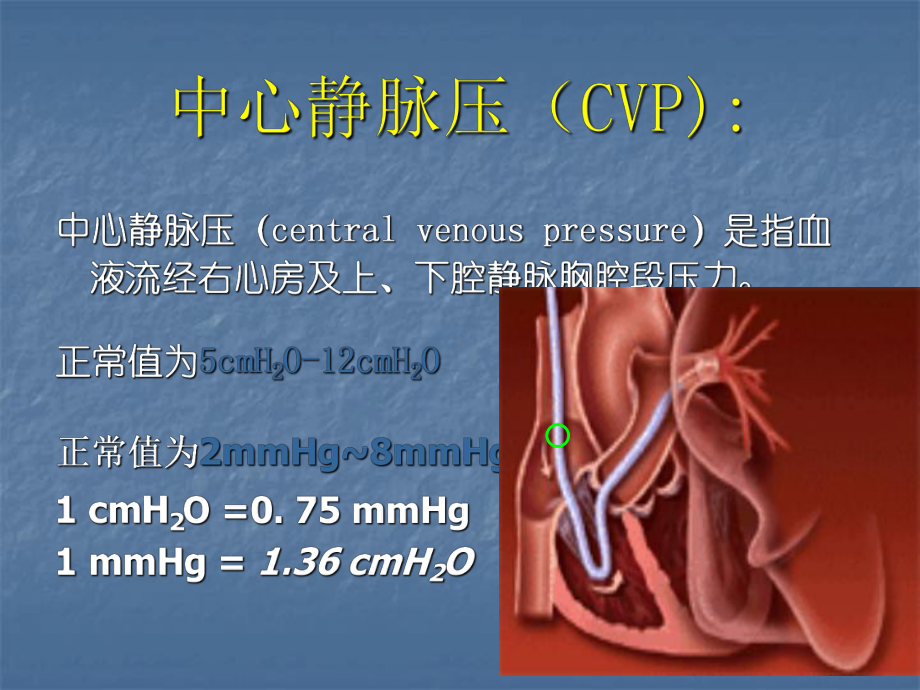 中心静脉压(CVP)监测及波形分析课件.ppt_第3页