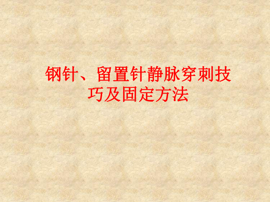 钢针、留置针静脉穿刺技巧及固定方法全-38页PP课件.pptx_第1页