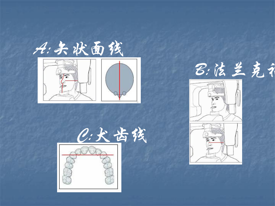 牙片机拍摄程序定位课件.ppt_第3页