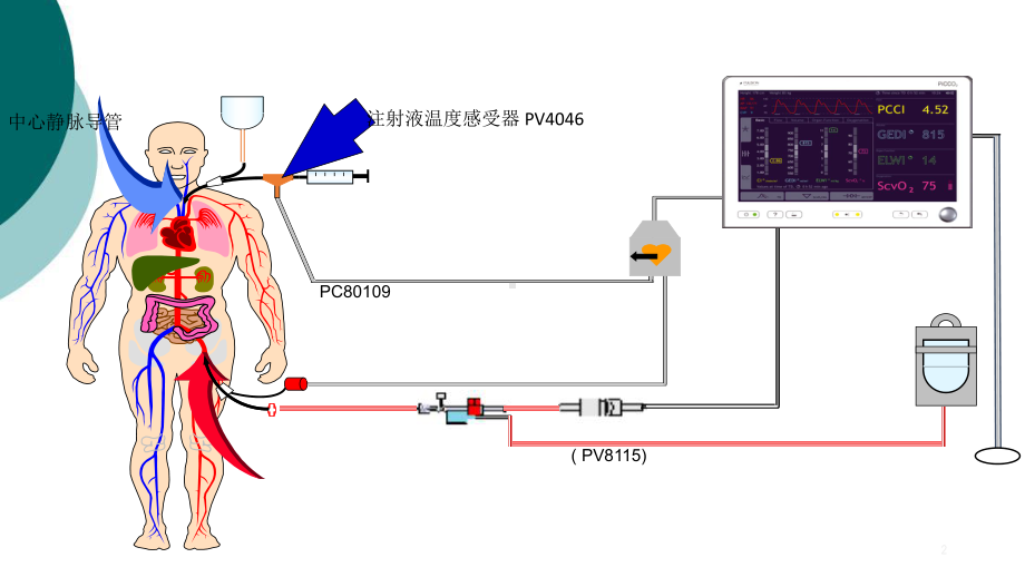 PiCCO参数解读-标准版课件.ppt_第2页