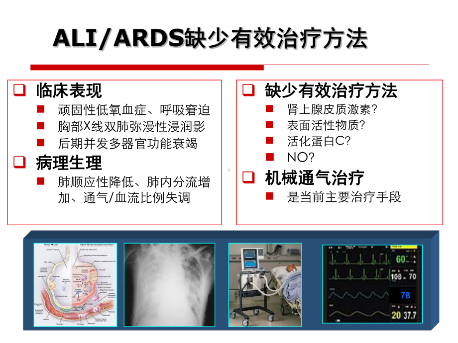 液体通气应用前景课件.ppt_第2页