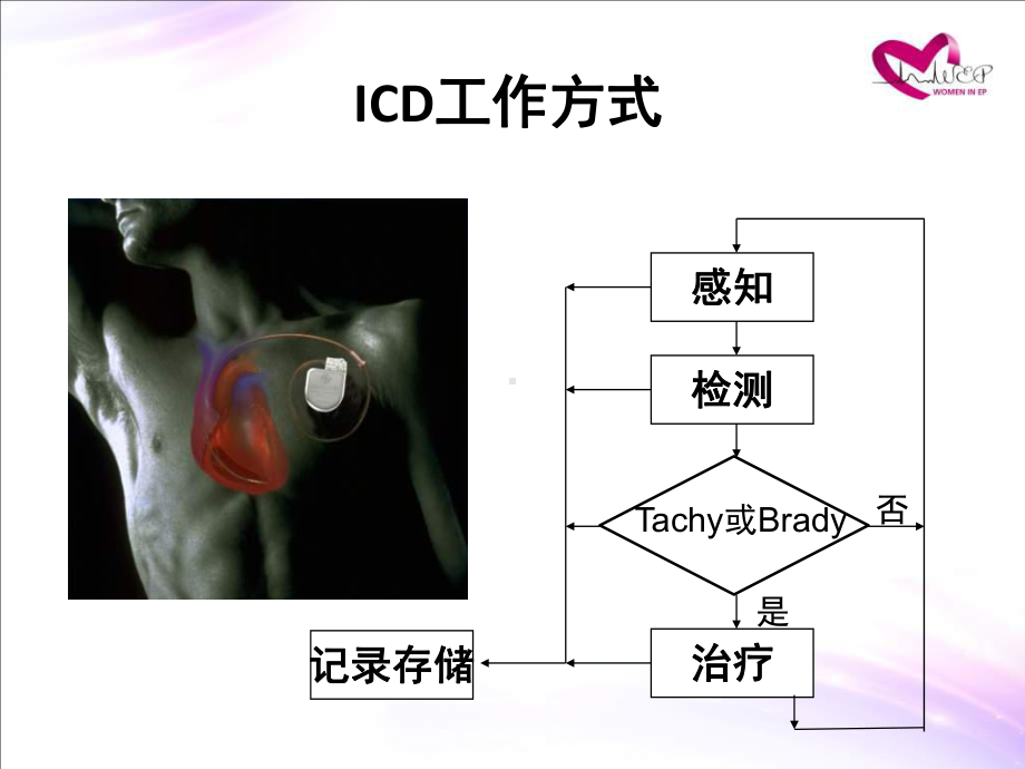 icd的参数设置课件.pptx_第1页