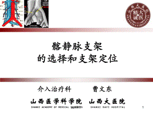 髂静脉支架的选择和支架定位-ppt课件.ppt