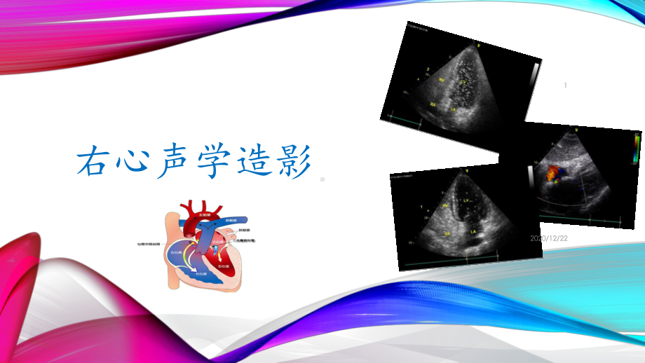 右心声学造影-ppt课件.pptx_第1页