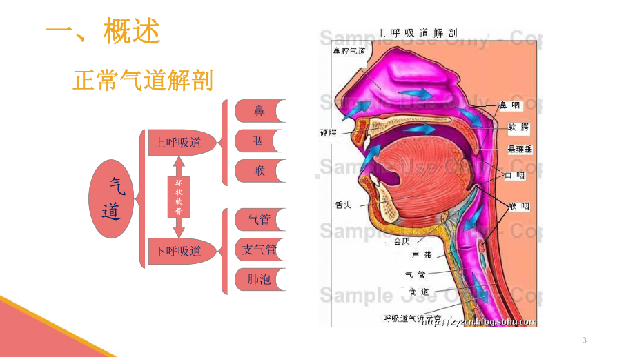 危重病人的紧急气道管理PPT课件.ppt_第3页