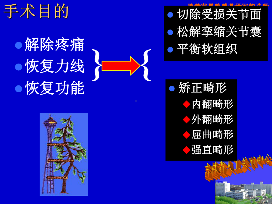 膝关节置换截骨平面的选择PPT课件.ppt_第2页