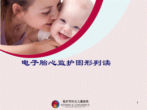 胎心监护图形判读PPT课件.ppt