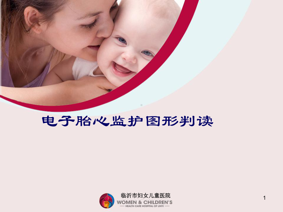 胎心监护图形判读PPT课件.ppt_第1页