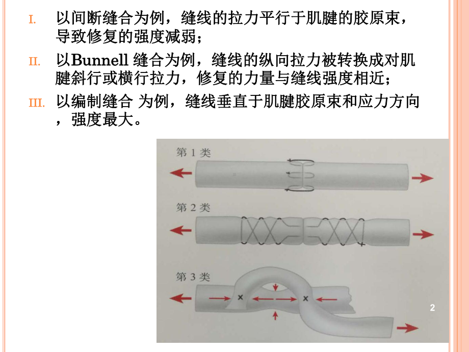 肌腱缝合技术PPT课件.ppt_第2页