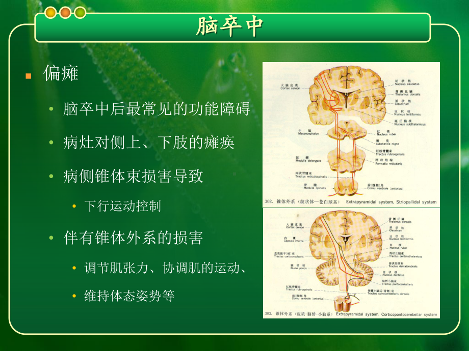 脑卒中后运动功能障碍的特点和评定-继续教育学习班(花课件.ppt_第2页