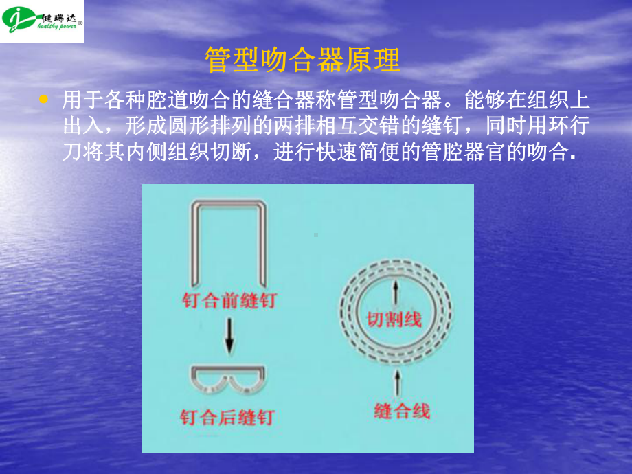 一次性弯管型吻合器教材课件.ppt_第3页