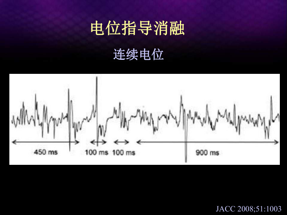 慢性房颤导管消融的技术与评价马长生课件.pptx_第3页