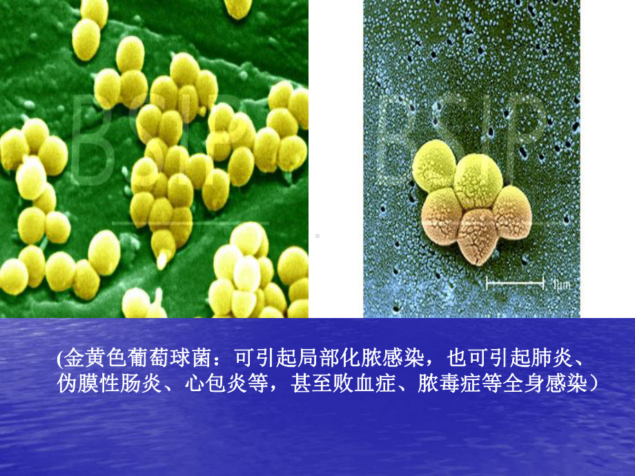 科学合理使用抗菌药物课件.ppt_第3页