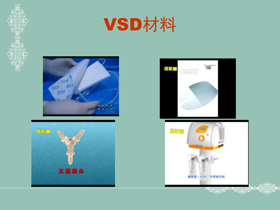 vsd-负压吸引技术-的概述课件.ppt_第3页