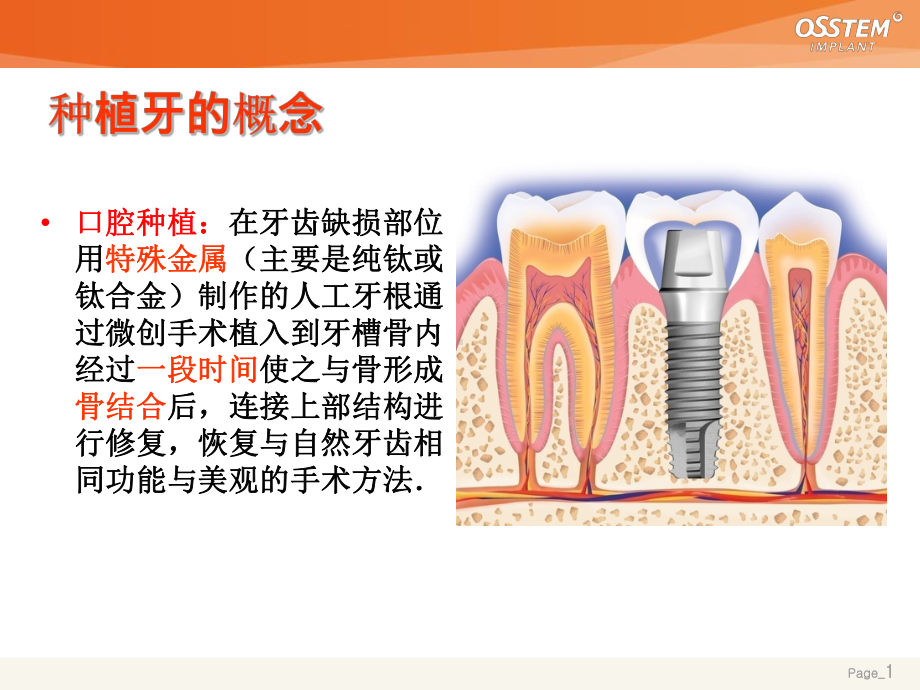 种植牙Osstem-基础课件.ppt_第1页