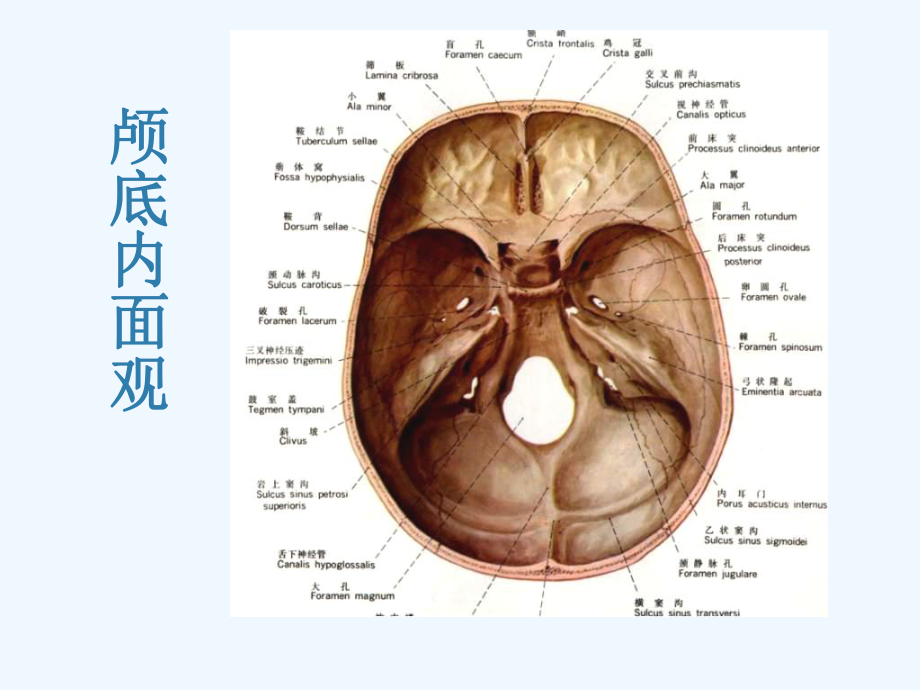 颅底结构影像解剖及病变分析课件.ppt_第3页