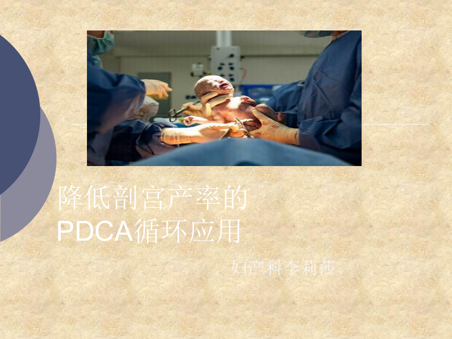 降低剖宫产率的PDCA循环应用课件.ppt_第1页