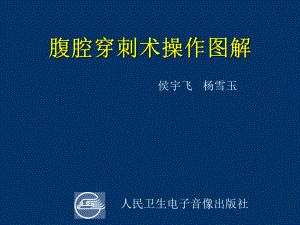 腹腔穿刺术操作图解课件.ppt