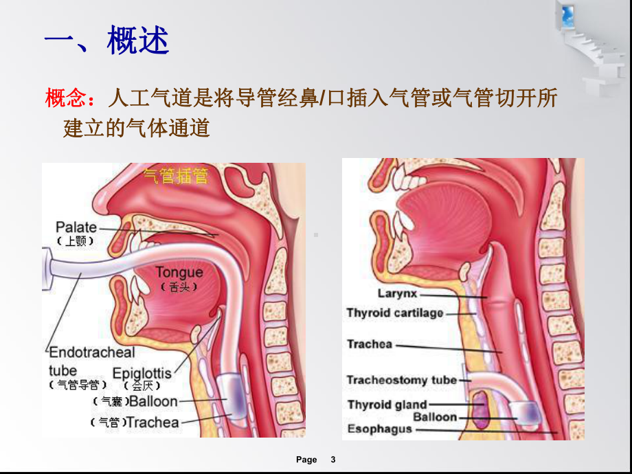 人工气道管理新进展课件.ppt_第3页