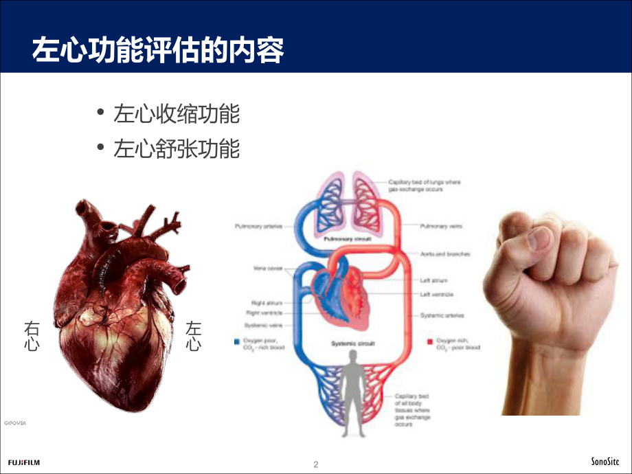 超声评估左心收缩功能—视觉评估和定量测量课件.pptx_第2页