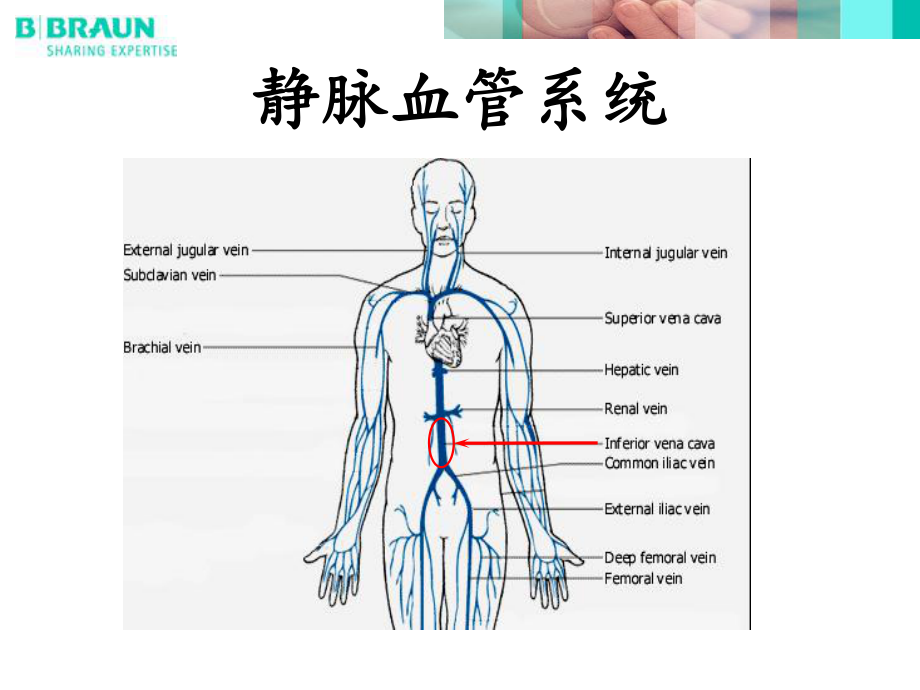 贝朗滤器介绍课件.ppt_第2页