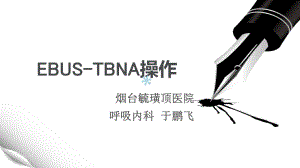 EBUSTBNA操作流程课件.ppt