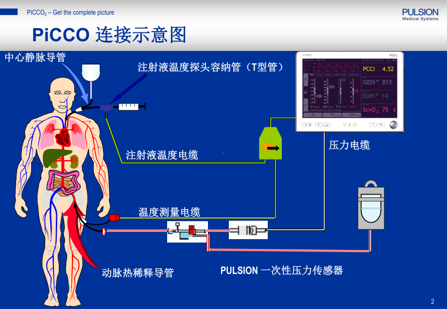 PiCCO参数解读-阜外医院课件.ppt_第2页