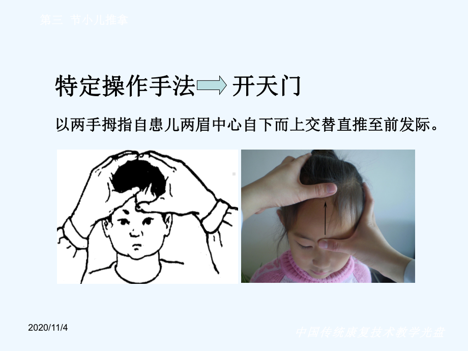 第三章推拿技术第三节小儿推拿课件.ppt_第3页