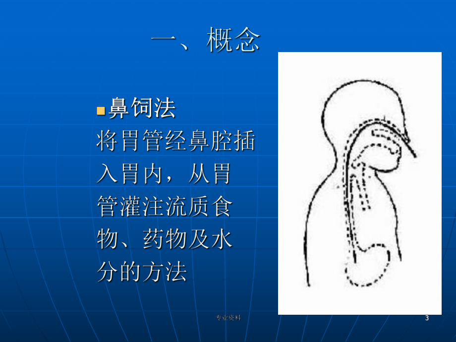 鼻饲法操作PPT[专家指导]课件.ppt_第3页