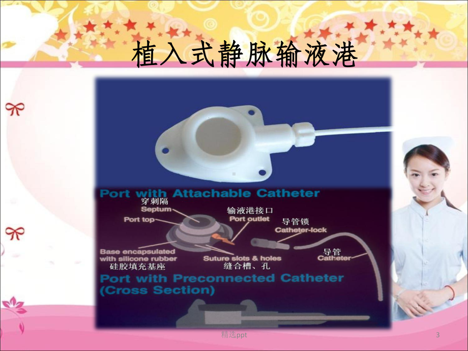 输液港的使用与维护课件.ppt_第3页