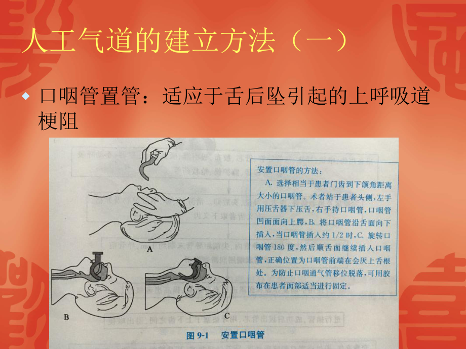 人工气道管理和呼课件.ppt_第3页