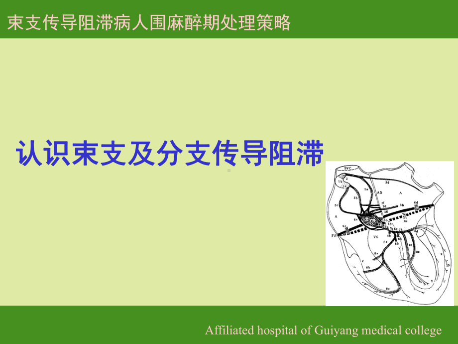 束支传导阻滞病人围术期管理策略课件.ppt_第3页