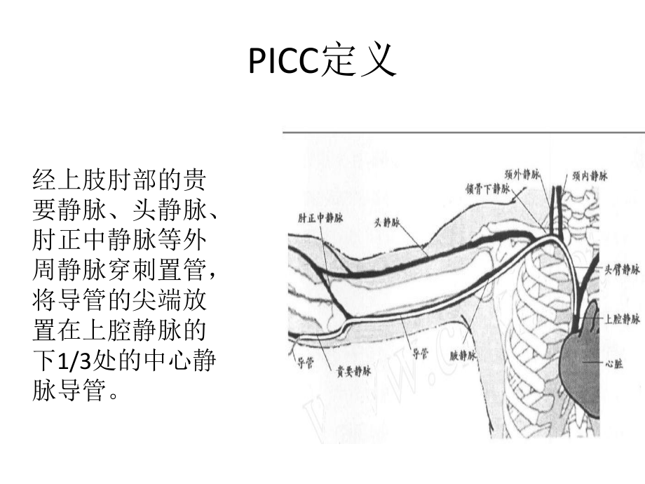 外周静脉穿刺置入中心导管课件.ppt_第3页