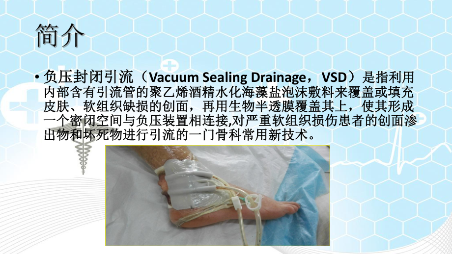 vsd负压引流术课件.ppt_第2页