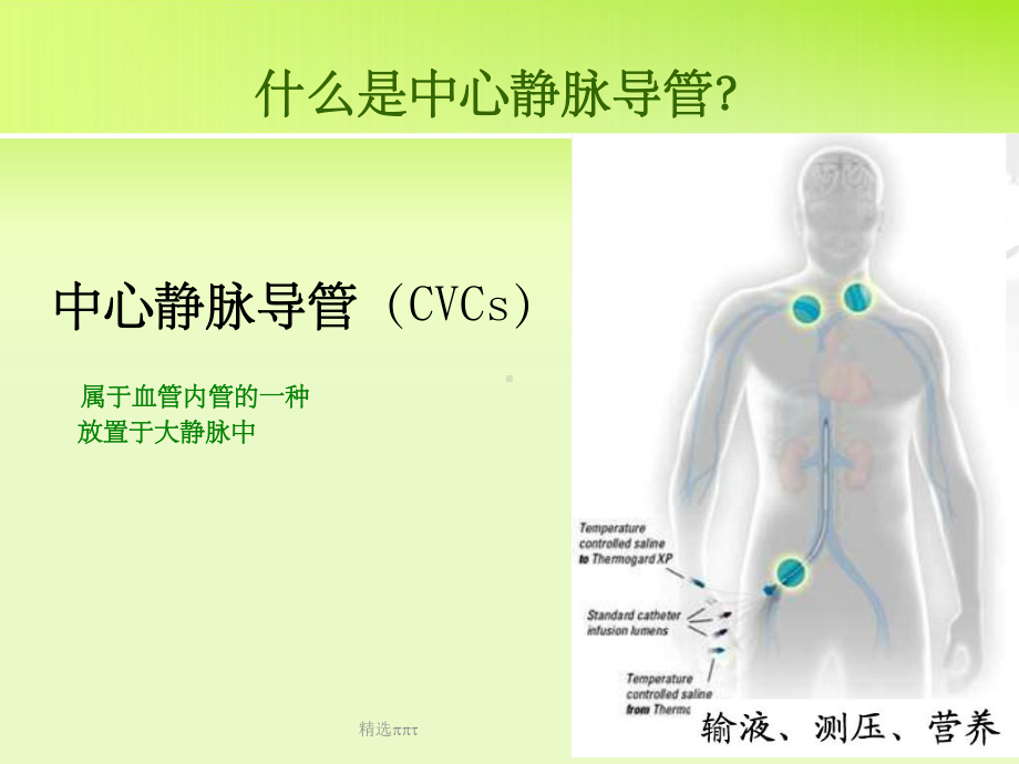 中心静脉导管堵塞原因及对策课件.ppt_第2页