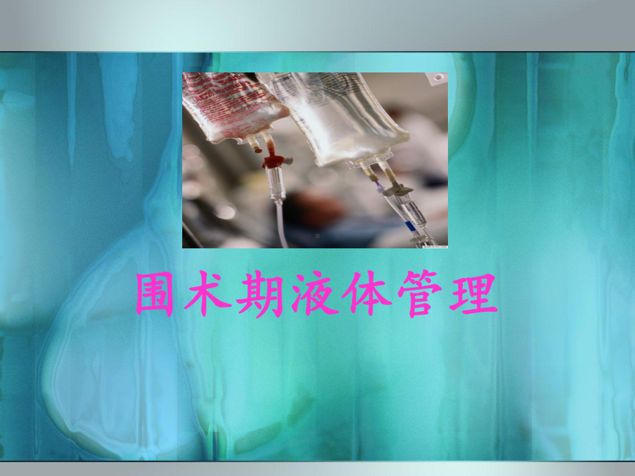 围术期液体管理课件.ppt_第1页