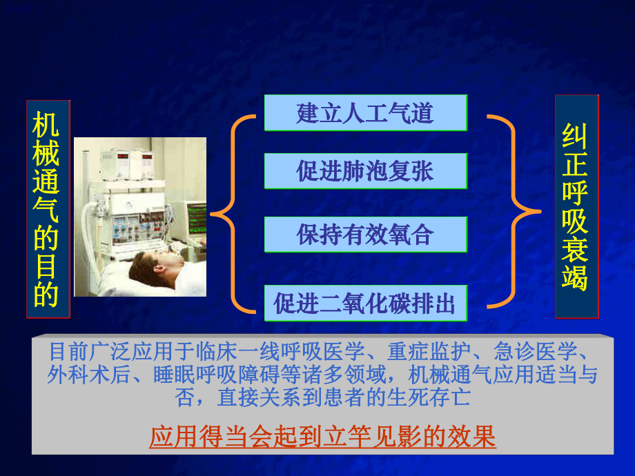 机械通气与RM课件.ppt_第3页