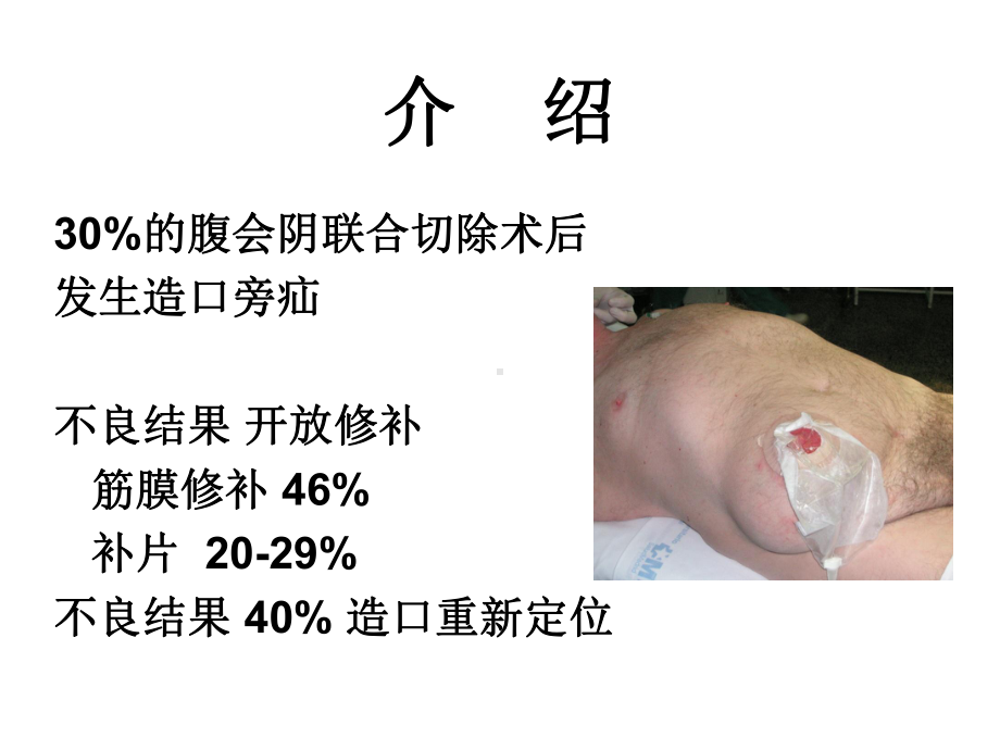 使用IPST补片的腹腔镜造口旁疝修补术课件.ppt_第2页