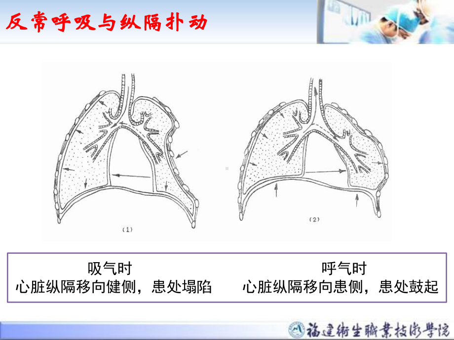 肢体缩短-福建卫生职业技术学院课件.ppt_第3页