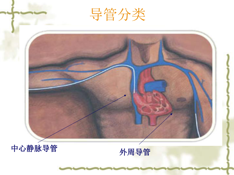 静脉输液工具的选择及维护1课件.ppt_第3页