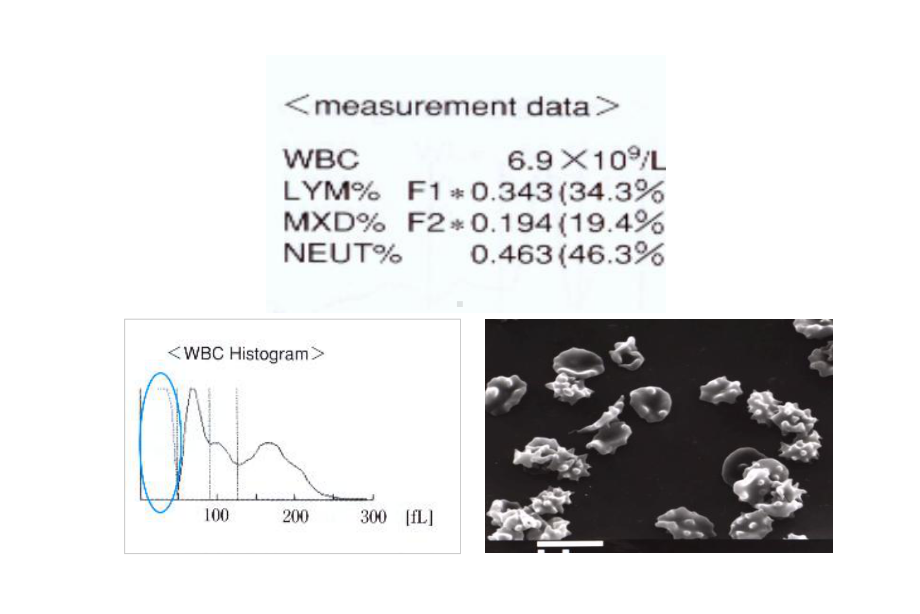 血常规分析中的误差因素及血涂片复检规则(北京)崔巍精要课件.ppt_第2页