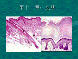 组织胚胎学-第11章皮肤课件.ppt