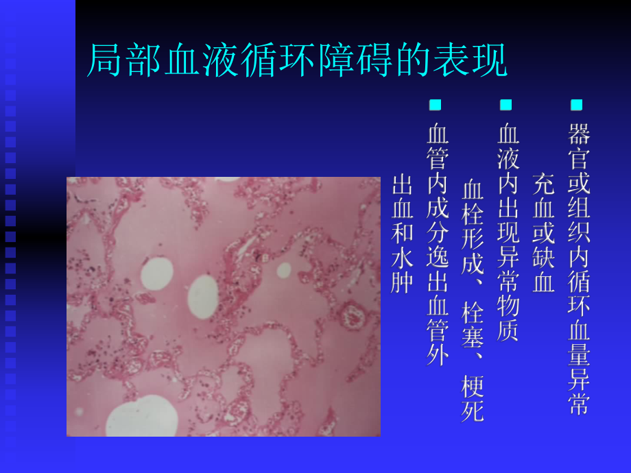 三局部血液循环障碍（精品PPT）课件.ppt_第3页