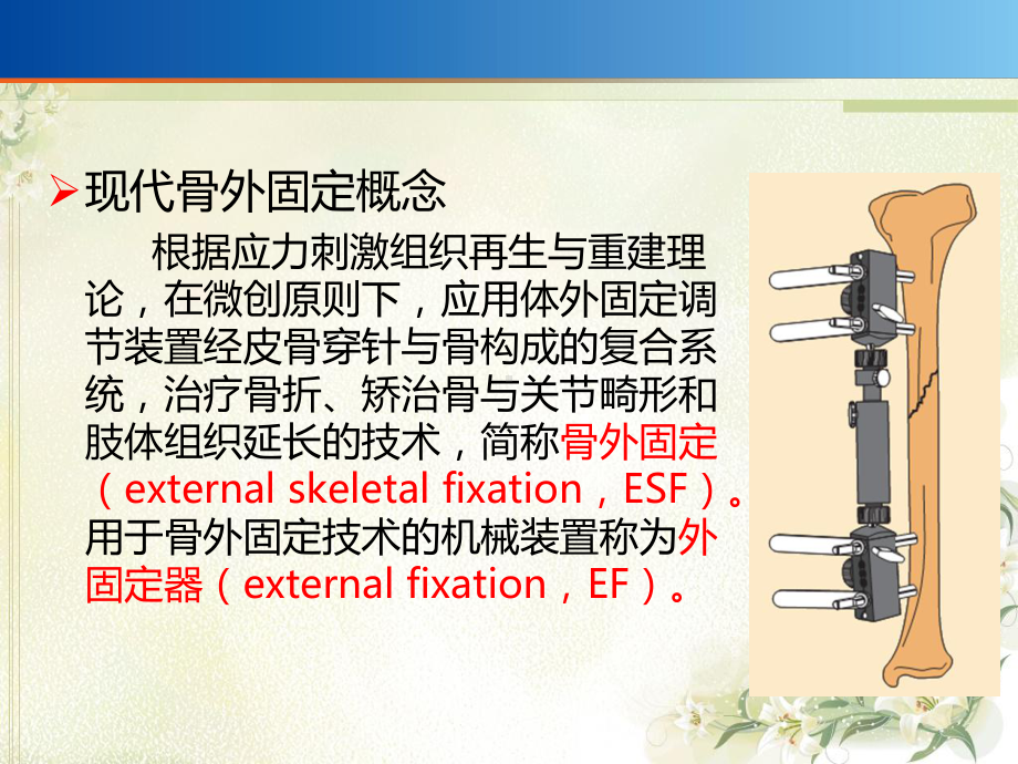 外固定架课件.ppt_第2页